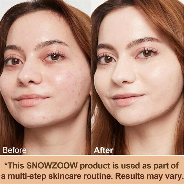 Radiate Confidence with Flawless, Natural Beauty