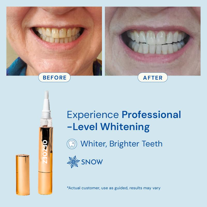 Radiant Smile Whitening Kit™